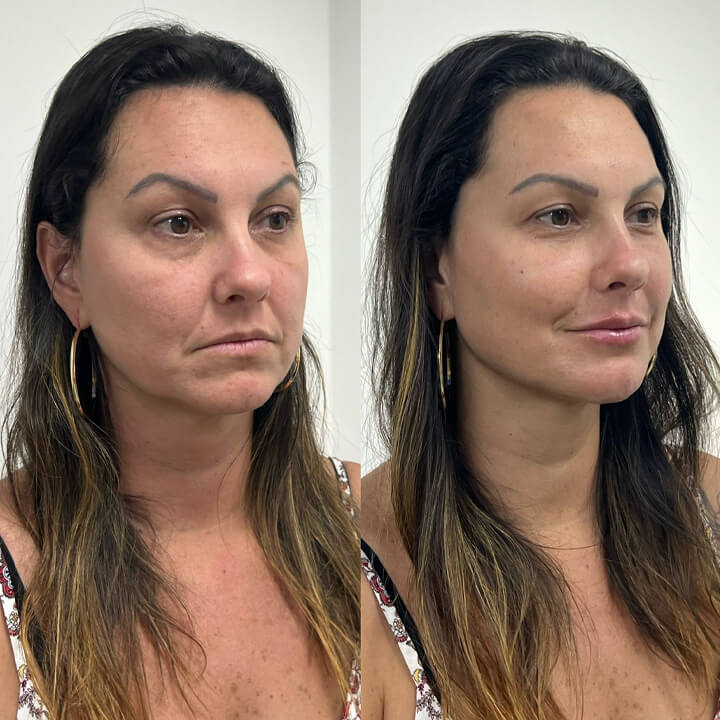 Antes e depois 3