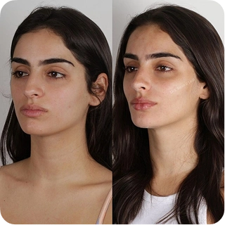 antes-e-depois13.webp