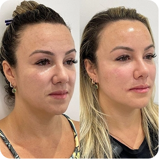 antes-e-depois14.webp