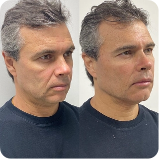 antes-e-depois15.webp