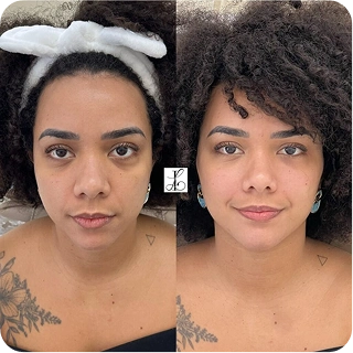 antes-e-depois16.webp
